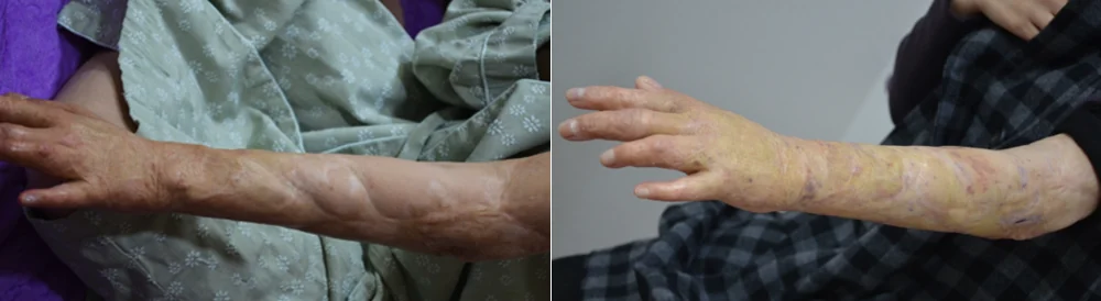 사고응급 골든타임 치료 시술 전후 사진 1 · 보니따의원