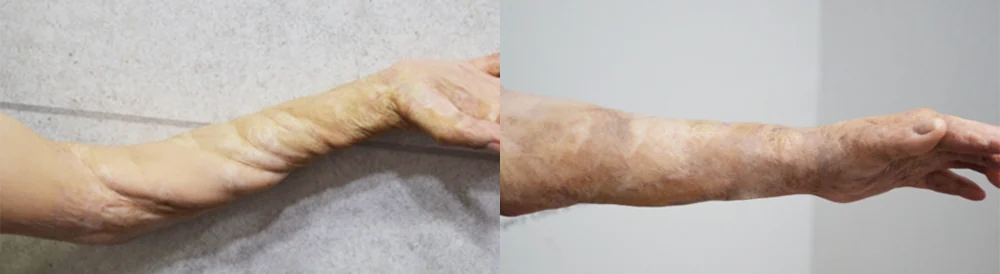 사고응급 골든타임 치료 시술 전후 사진 2 · 보니따의원