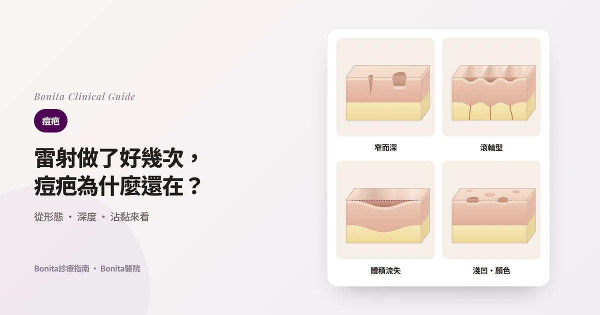 四個皮膚截面塊分別畫出窄而深的疤痕、底部被纖維束拴住而呈波浪狀凹陷的疤痕、體積流失形成的大片凹陷，以及淺凹陷和紅褐色印子，並寫出常用的治療