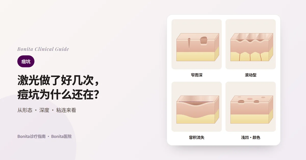 四个皮肤截面块分别画出窄而深的疤痕、底部被纤维束拴住而呈波浪状凹陷的疤痕、容积流失形成的大片凹陷,以及浅凹陷和红褐色印记,并写出常用的治疗