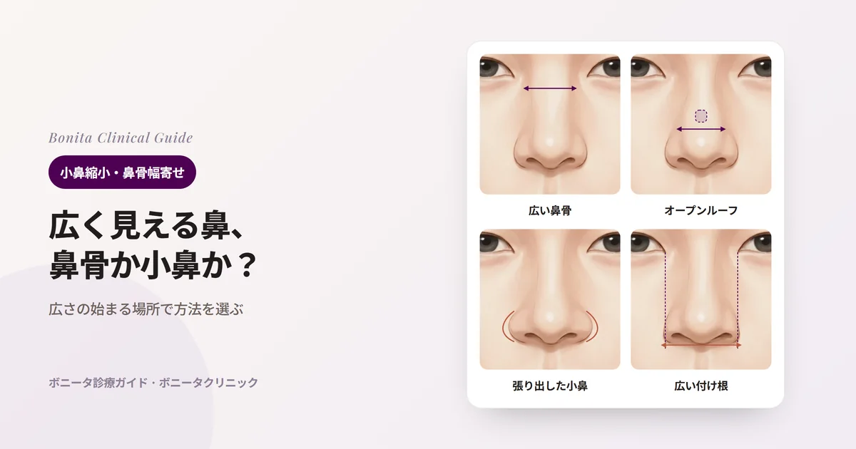 同じ正面の顔の図四枚で、鼻筋の上部、ハンプを削った後の鼻筋の中ほど、小鼻、小鼻の付け根だけをそれぞれ広く描き、確かめることと検討する方法を記したカード