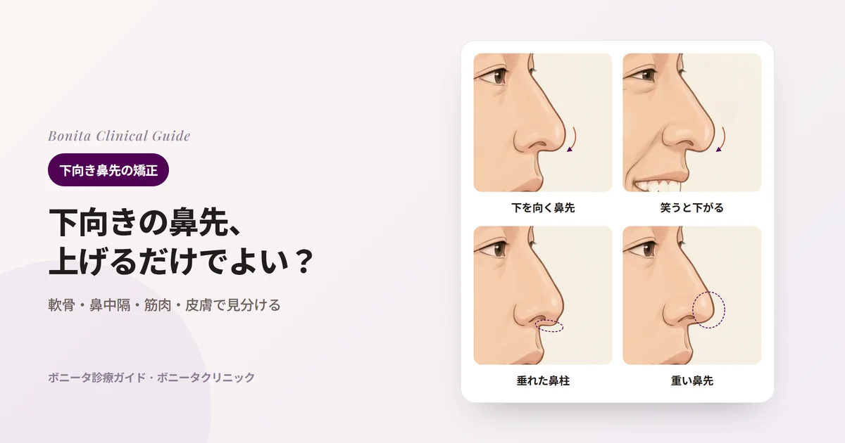 同じ人の横顔の鼻のイラスト四枚：鼻先が唇のほうへ下を向いた様子、笑うと鼻先がさらに下がった様子、鼻柱が垂れた様子、鼻先が重く下がった様子。カードごとに考えられる原因と確認することを書いた。