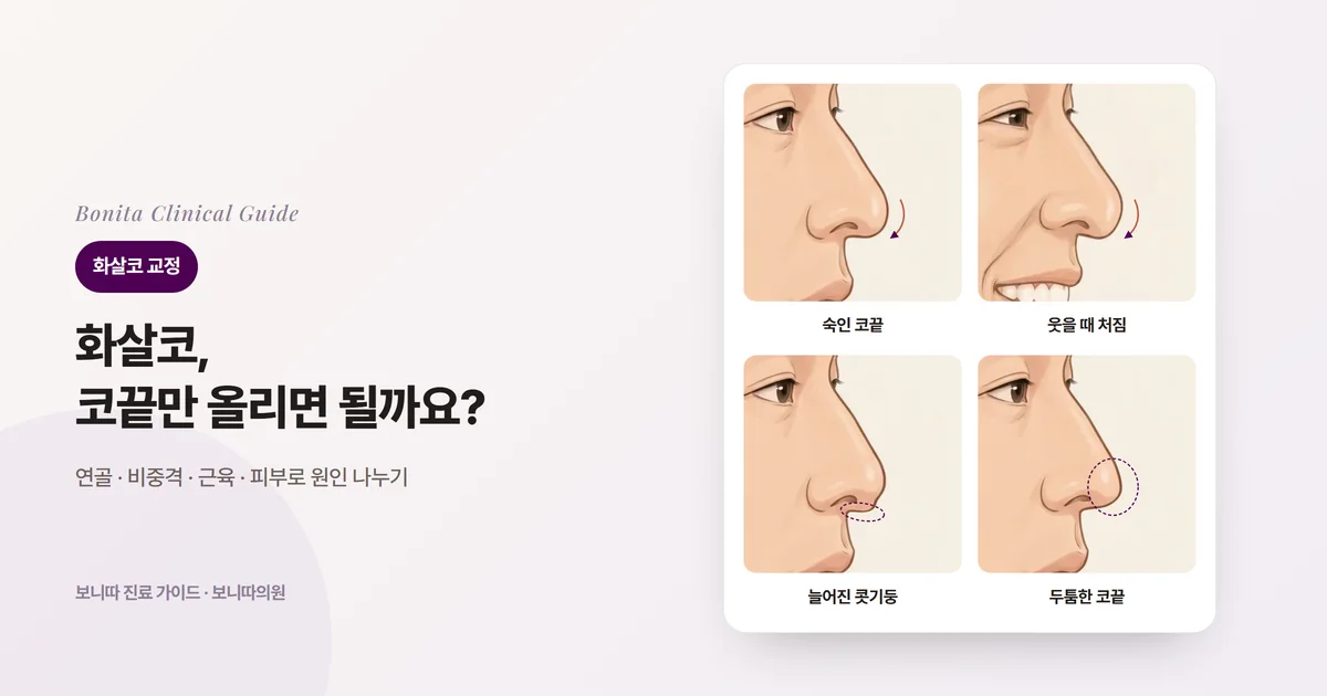 같은 사람의 옆모습 코 삽화 네 장: 코끝이 입술 쪽으로 숙여진 모습, 웃을 때 코끝이 더 내려온 모습, 콧기둥이 아래로 늘어진 모습, 코끝이 두툼하고 처진 모습. 카드마다 생각할 수 있는 원인과 확인할 것을 적었다.