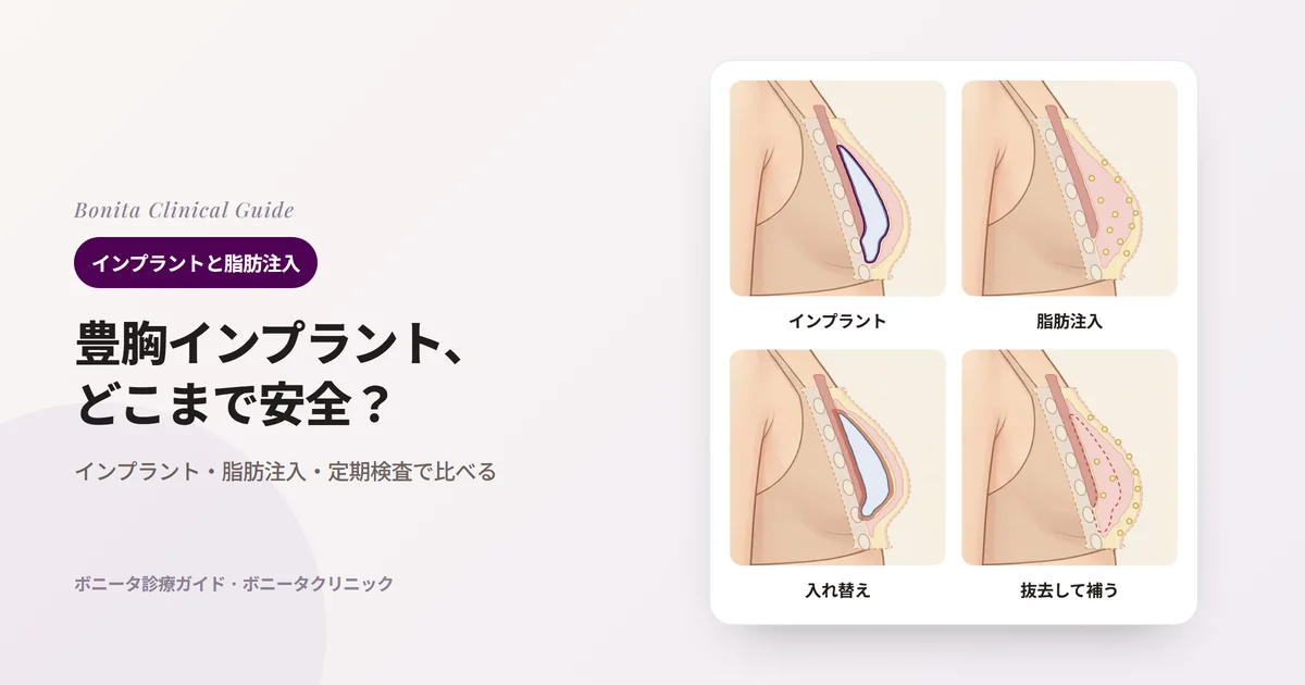 乳房を横から切った断面4枚:乳腺下に入ったインプラントと被膜、乳房の組織の間に少しずつ入れた脂肪、厚くなった被膜に押されたインプラント、インプラントを抜いた後の空間と皮下に入れた脂肪。それぞれ検討される場面と知っておきたい点を書いたカード