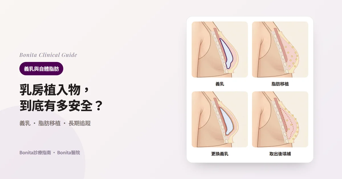 四張乳房側面剖面圖:乳腺下的義乳與莢膜、分小份注入乳房組織之間的脂肪、被增厚莢膜擠壓的義乳、取出義乳後的空間與注入皮下的脂肪,並寫出各自適合的情況與需要了解的重點