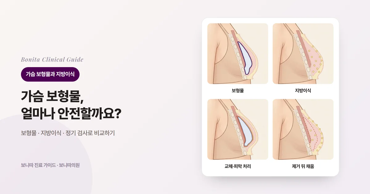 가슴을 옆에서 자른 단면 네 장: 유선 아래에 놓인 보형물과 피막, 가슴 조직 사이사이에 조금씩 넣은 지방, 두꺼워진 피막에 눌린 보형물, 보형물을 뺀 자리와 피하 조직에 넣은 지방. 각각 고려하는 경우와 알아 둘 점을 적은 카드