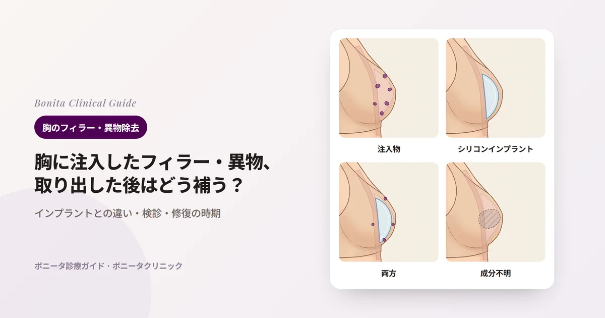 同じ胸の横顔4枚に中の様子を重ね、注入した物質だけ、シリコンインプラントだけ、両方、何かわからない場合を描き、それぞれの進め方を記したカード