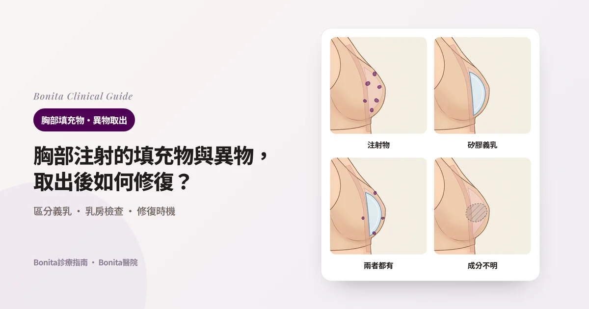 在同一張乳房側面圖上疊畫內部情況的四張卡片:只有注射物、只有矽膠義乳、兩者都有、不清楚是什麼,並寫出各自的處理方向