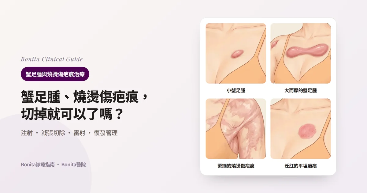 在前胸插畫上分別畫出胸部中央的小蟹足腫、胸部和肩部又大又厚的蟹足腫、肩部和腋前緊繃的大面積燒燙傷疤痕、鎖骨下方平坦但泛紅的疤痕，並寫出先考慮的治療的四張卡片