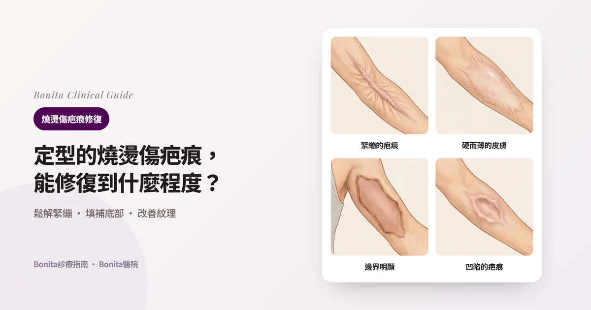 在手臂插畫上分別畫出橫過肘窩緊繃的厚疤痕帶、前臂變硬變薄的疤痕皮膚、上臂邊界明顯的大面積疤痕、前臂凹陷的疤痕,並寫出Bonita醫院方法的四張卡片