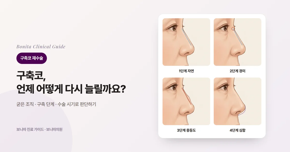 같은 옆얼굴 그림 네 장으로 나타낸 실리콘 보형물 뒤 피막 구축의 네 단계: 겉에서 보이지 않는 보형물(점선), 가장자리가 부자연스러운 보형물, 휘어진 보형물과 딱딱해진 피부, 원래 윤곽(점선)보다 짧아지고 들린 코끝