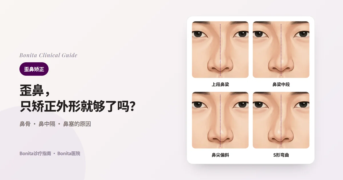 同一个人的四张正面鼻子插图和脸部中线虚线:上段鼻梁(鼻骨)倾斜、鼻梁中段弯曲、鼻小柱与鼻尖偏向一侧、S形弯曲,每张卡片写出考虑的矫正方法。