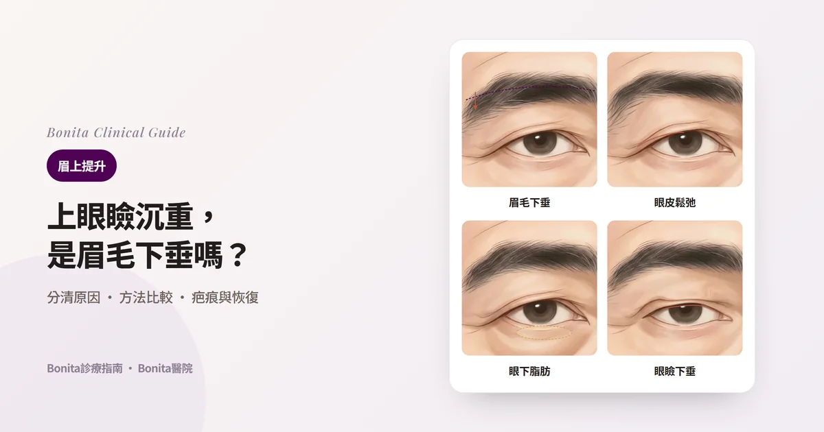 四張眼部插圖卡片：眉毛下垂的眼睛、上眼瞼皮膚鬆弛的眼睛、眼下脂肪突出的眼睛、眼瞼邊緣遮住黑眼珠的眼睛，以及各自優先考慮的方法