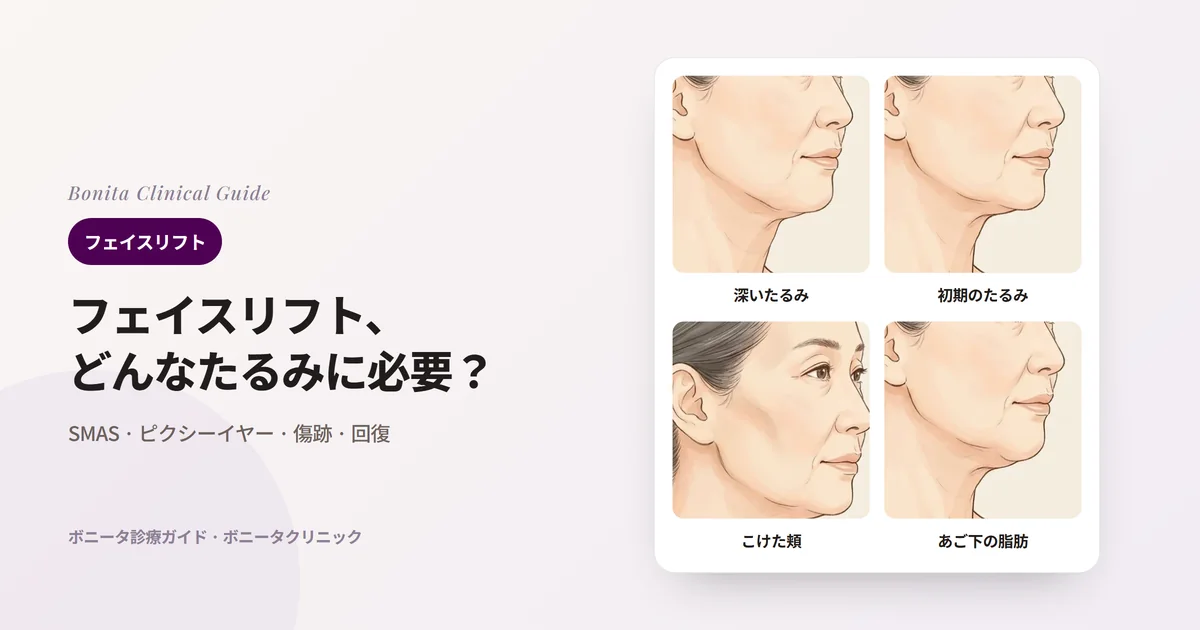 同じ50代女性の横顔のイラスト4枚：あごのたるみと首の皮膚のゆるみ、初期のたるみ、頬のくぼみ、あご下の脂肪と、それぞれまず検討する方法を記したカード