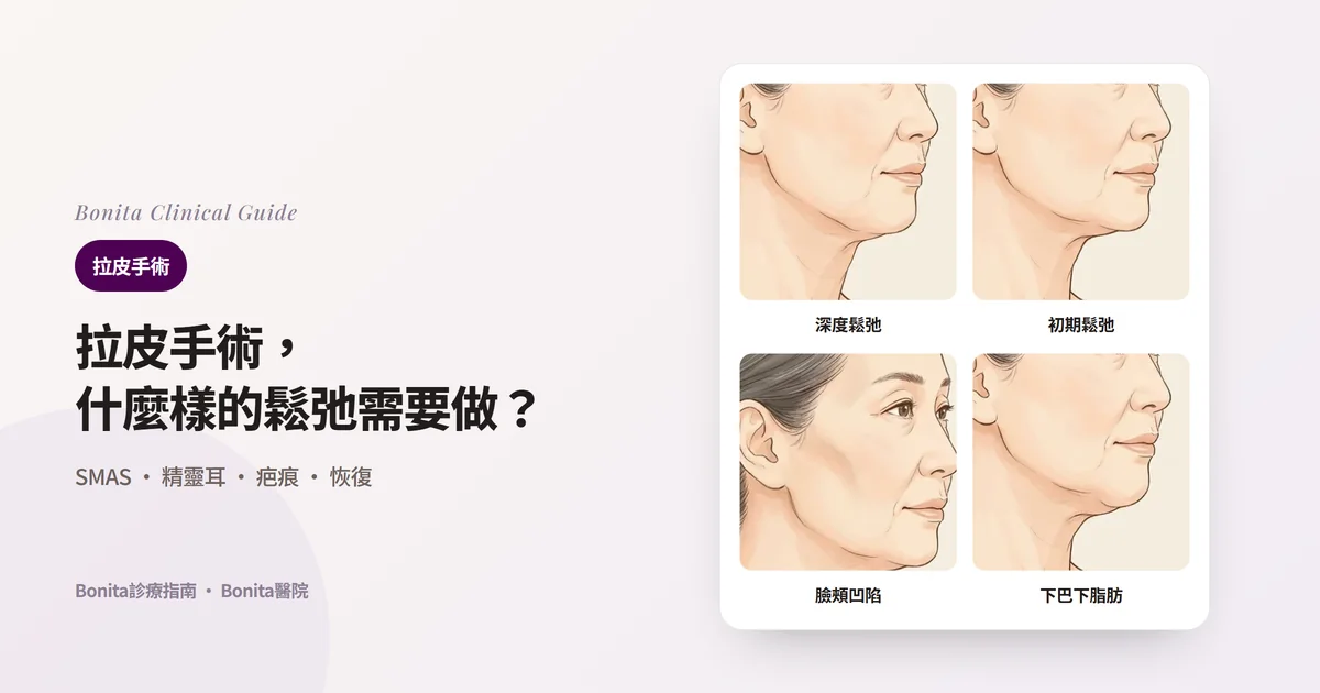 同一位50多歲女性的四張側臉插畫：下顎贅肉下垂與頸部皮膚鬆弛、初期鬆弛、臉頰凹陷、下巴下方脂肪較多，並寫明各自優先考慮的方法