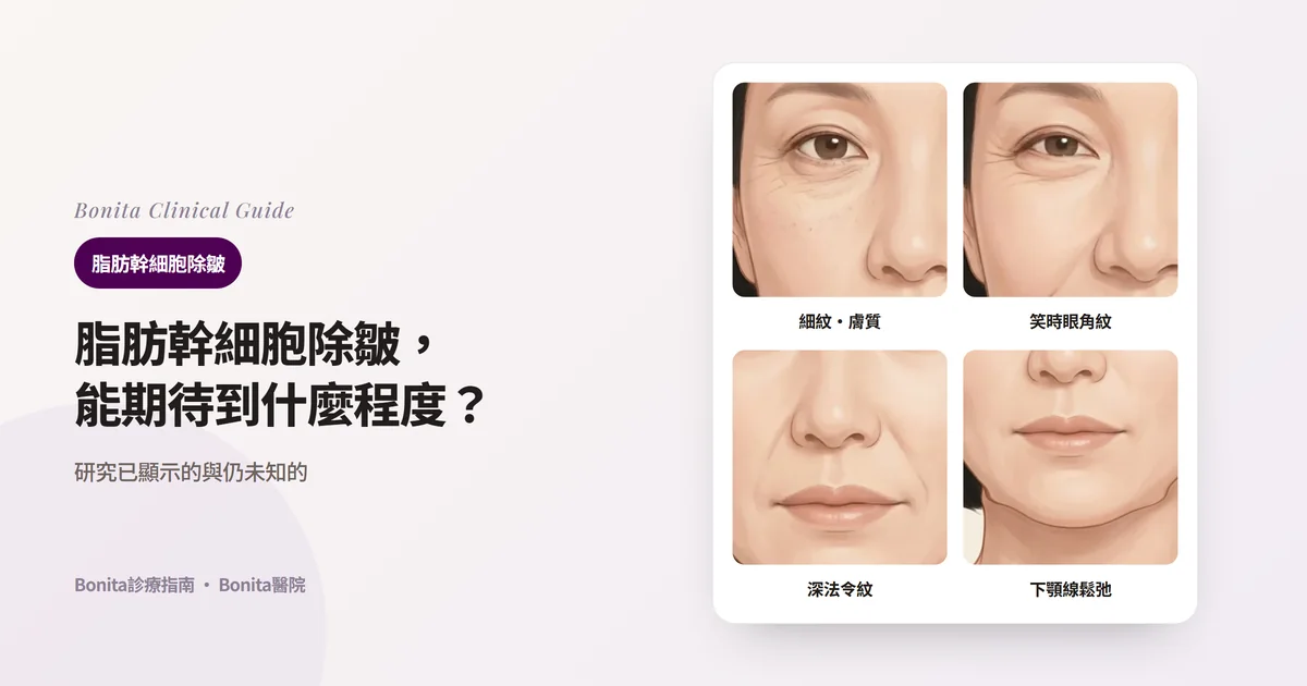 同一位40多歲女性的四張正面插畫：靜態時可見的細紋與粗糙膚質、笑時眼角出現的表情紋、深的法令紋、鬆弛的下顎線，並寫明各自優先考慮的方法