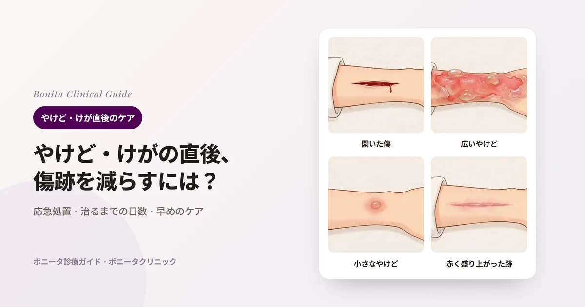 前腕のイラスト4枚に、血が出て開いた傷、水ぶくれのある広いやけど、硬貨ほどの小さなやけど、治ったが赤く盛り上がった傷跡をそれぞれ描き、最初にすることを書いたカード