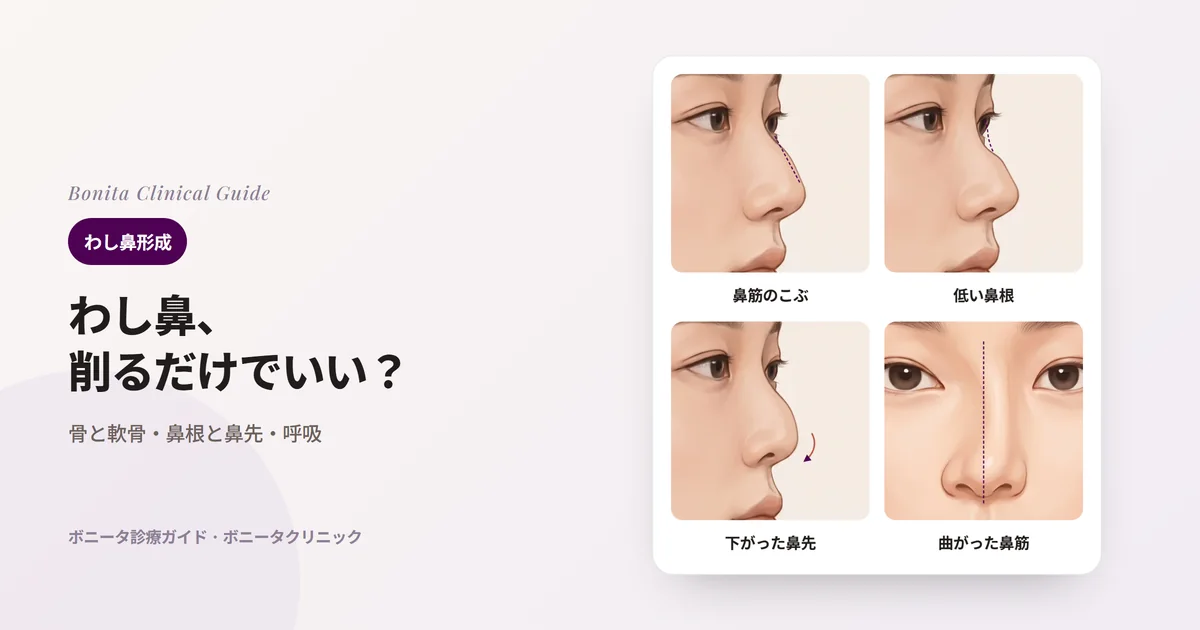 鼻のイラスト四枚に、はっきりしたハンプ、低い鼻根、下がった鼻先、片側に曲がった鼻筋をそれぞれ示し、主に検討する方法を書いたカード