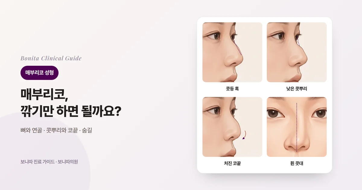 코 삽화 네 장에 뚜렷한 혹, 낮은 콧뿌리, 처진 코끝, 한쪽으로 휜 콧대를 각각 표시하고 주로 검토하는 방법을 적은 카드