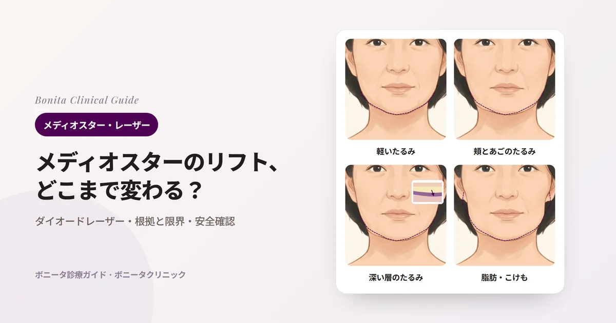 正面の顔のイラスト4枚に、元の輪郭(点線)とともに、フェイスラインが少し下がり始めた様子、頬とあごがはっきりたるんだ様子、皮膚より深い層から始まったたるみ(小さな断面)、脂肪・たるみ・こけが重なった様子を示し、まず検討する方法を書いたカード