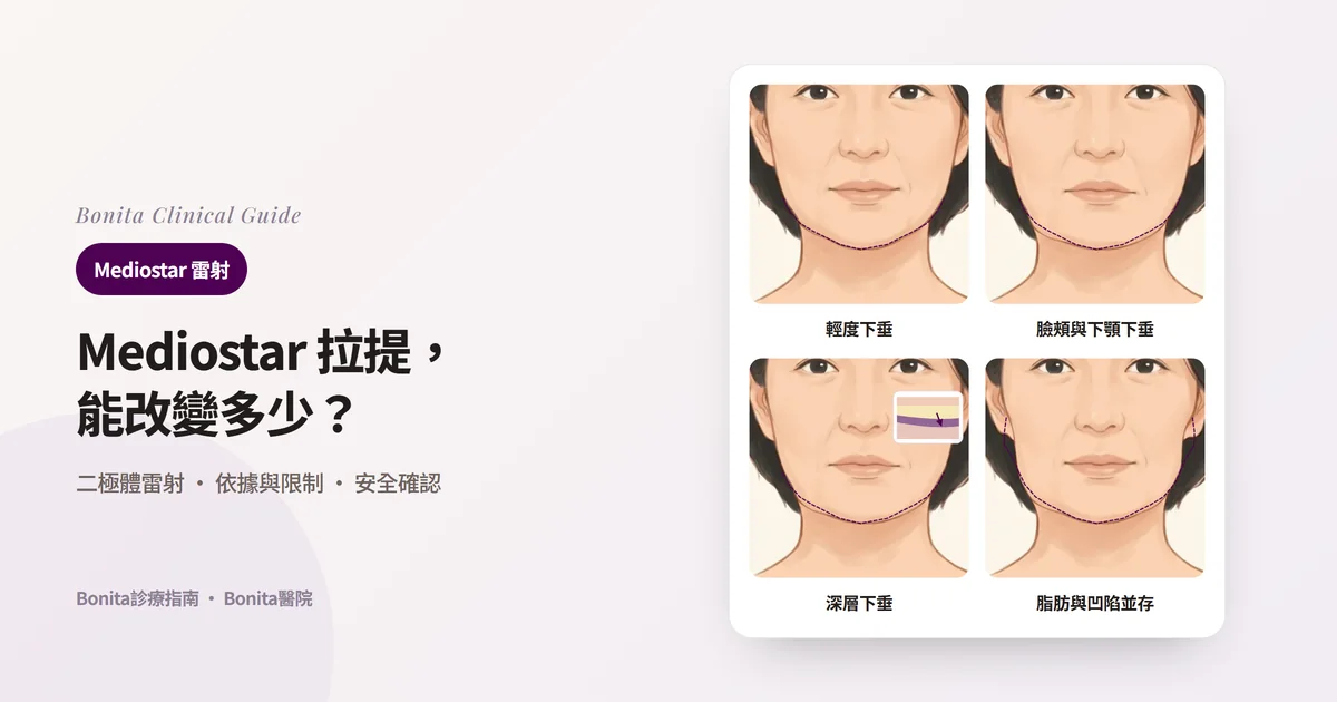 四張正面臉部插圖連同原輪廓(虛線)分別顯示:下顎線剛開始下垂、臉頰與下顎明顯下垂、從比皮膚更深的層開始的下垂(小剖面)、脂肪與下垂、凹陷並存,並寫出優先考慮的方法