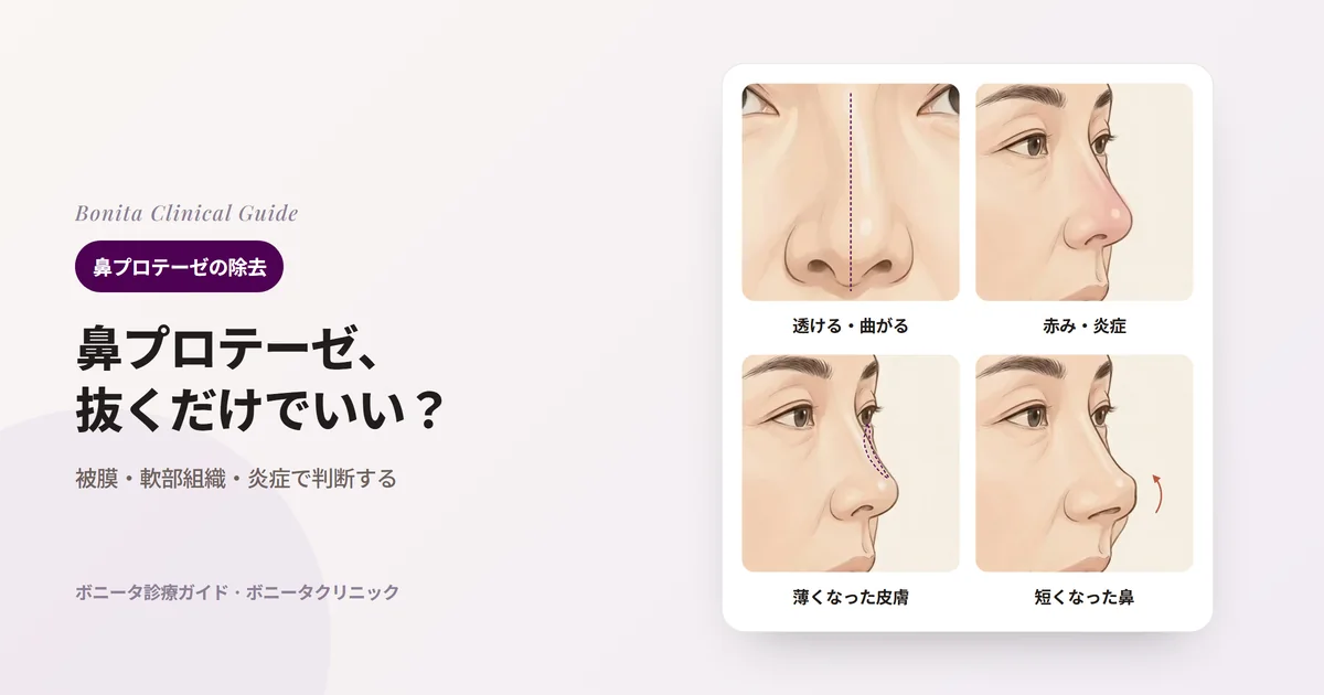 鼻プロテーゼの抜去を考える四つの理由を横顔のイラストに示したカード：透ける・曲がったプロテーゼ、くり返す赤みと炎症、薄く伸びた皮膚、短く上を向いた鼻
