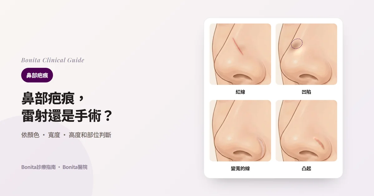 同一個鼻子的四張插畫分別畫出紅線和色沉、凹陷形成陰影的疤痕、沿鼻翼溝變寬的疤痕、凸起的疤痕,並寫出主要考慮的治療