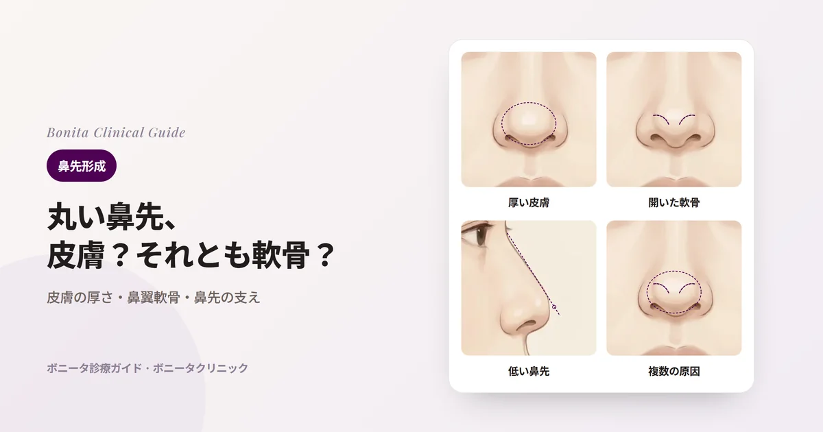 同じ人の鼻先のイラスト四枚:皮膚と軟部組織が厚く丸い鼻先(点線は覆う組織)、鼻翼軟骨が開いて広い鼻先(点線は軟骨の位置)、低く弱い鼻先の横顔(点線は鼻根と鼻先を結ぶ線)、いくつもの原因が重なった鼻先。カードごとに主に検討する方法を書いた。