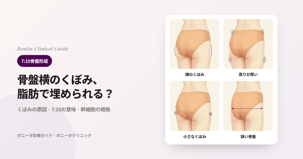 後ろから見た骨盤のイラスト4枚に、骨盤の横のくぼみ、周りが厚くてくぼみが目立つ場合、小さな範囲のくぼみ、骨盤の骨が狭い場合をそれぞれ示し、検討する方法と限界を書いたカード