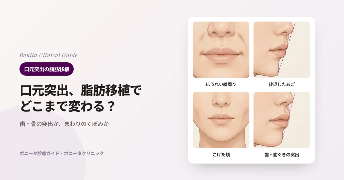 同じ20代女性のイラスト4枚:正面でほうれい線まわりがくぼんだ場合、横顔であご先が後ろに引っ込んだ場合、正面で頬がくぼんだ場合、横顔で唇が歯と一緒に前に出た場合と、それぞれまず確かめる内容を記したカード。横顔には鼻先とあご先を結ぶ線を点線で示した。