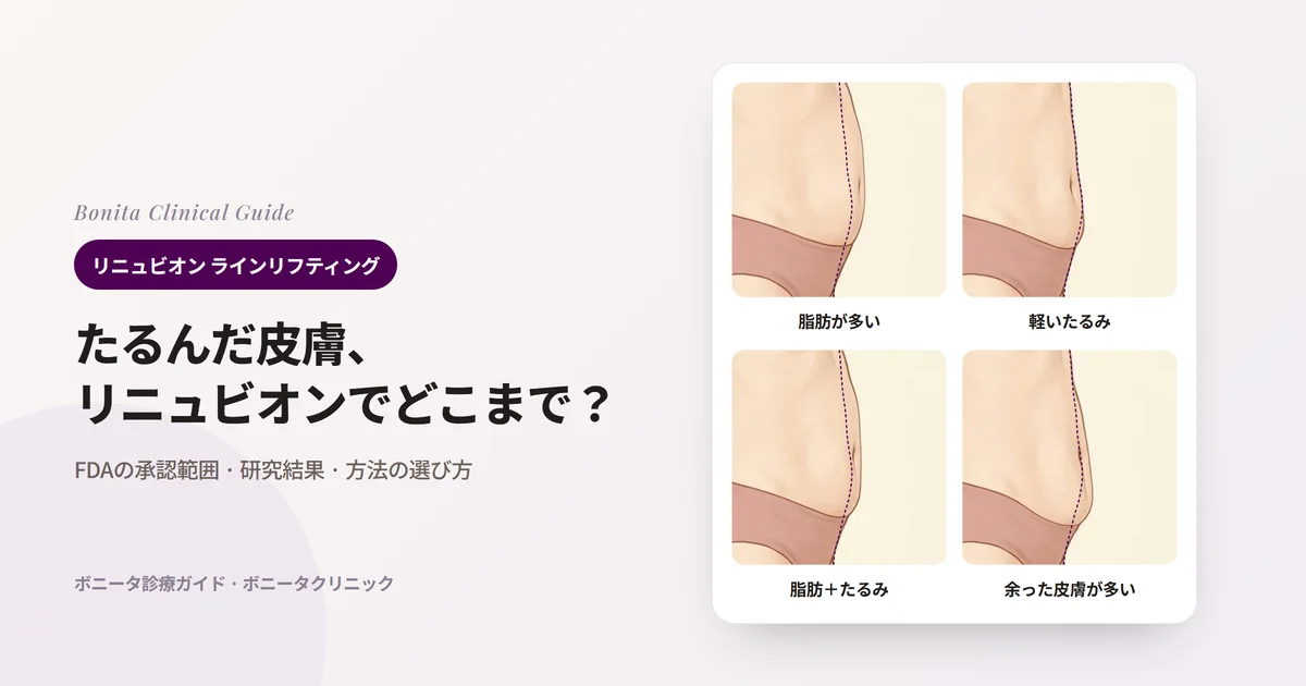 同じ人の横から見たおなかのイラスト4枚に、脂肪が多く丸く出たおなか、下腹の皮膚が軽くたるんだおなか、脂肪とたるみが一緒にあるおなか、余った皮膚が多く下に垂れたおなかを、もとの輪郭（点線）と一緒に示し、それぞれ検討する方法を書いたカード