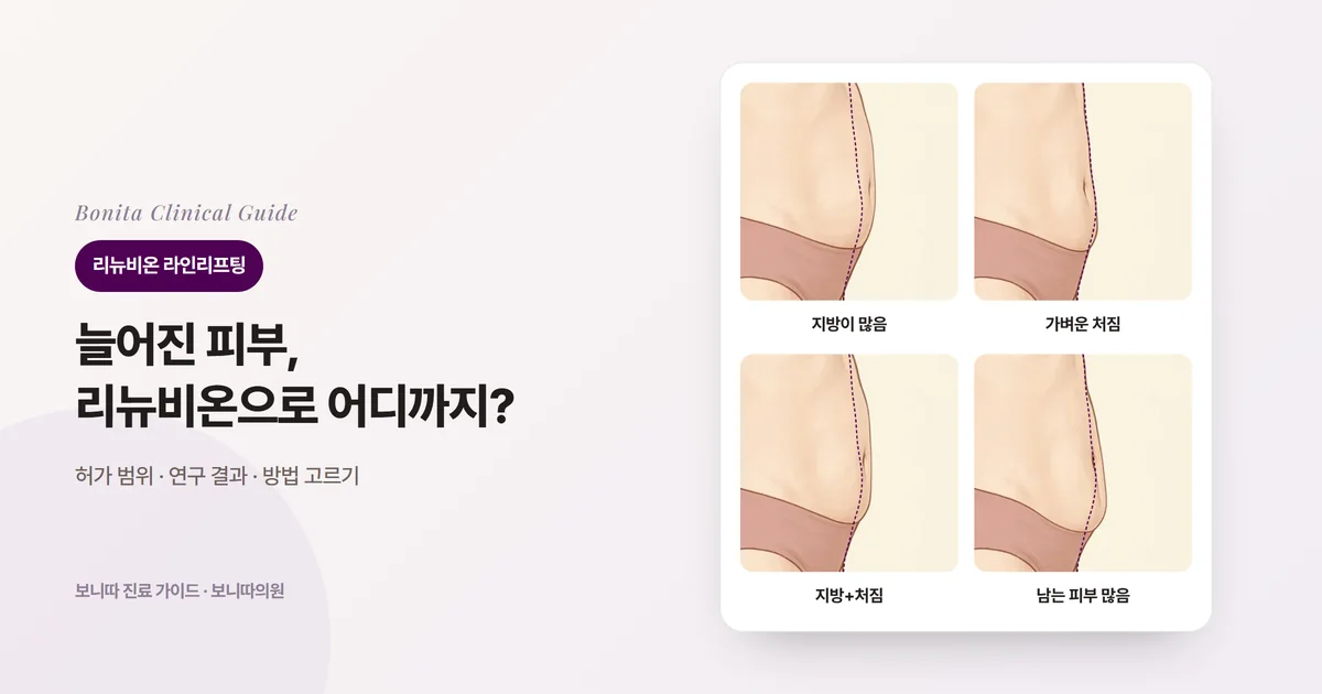 같은 사람의 옆모습 배 삽화 네 장에 지방이 많아 둥글게 나온 배, 아랫배 피부가 가볍게 처진 배, 지방과 처짐이 함께 있는 배, 남는 피부가 많아 아래로 늘어진 배를 처음 윤곽(점선)과 함께 보여 주고 각각 검토하는 방법을 적은 카드