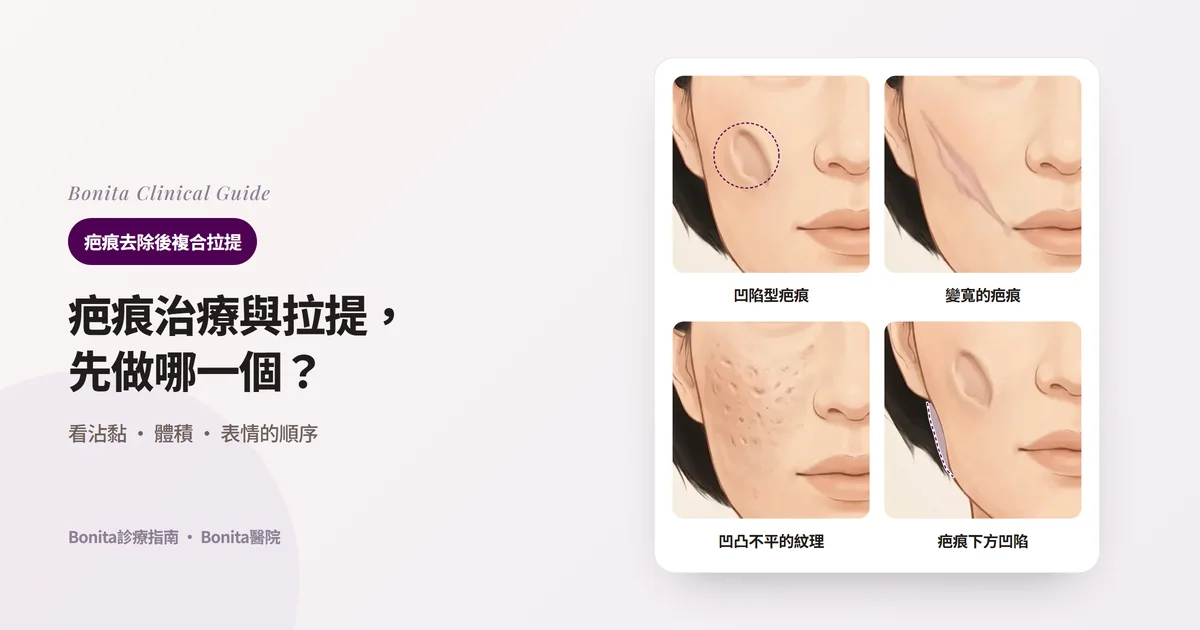 在同一張臉的同一側臉頰上分別畫出凹陷型疤痕、變寬的疤痕、凹凸不平的紋理和痕跡、疤痕下方凹陷的臉頰輪廓,並寫出各自先做的事的四張卡片