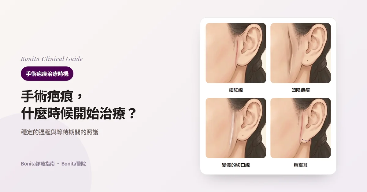 同一個人的側臉插畫四張,在耳前分別畫出細紅線疤痕、凹陷被牽拉的疤痕、明顯變寬的疤痕,以及耳垂被往前下方拉的精靈耳,並寫出Bonita醫院所用方法的卡片