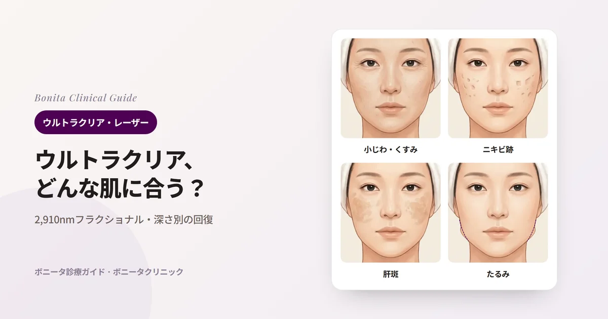 正面の顔のイラスト4枚に、目元の小じわと粗くくすんだ肌、両頬のへこんだニキビ跡、両頬の肝斑、元のフェイスライン（点線）より下がったあごを示し、まず見ることを書いたカード