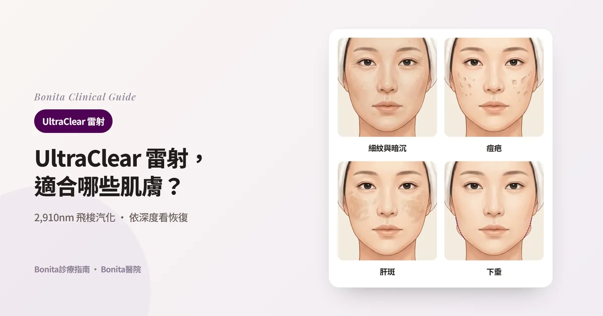 四張正面臉部插圖分別顯示眼周細紋與粗糙暗沉的皮膚、兩頰凹陷的痘疤、兩頰的肝斑、比原下顎線（虛線）下垂的下巴，並寫出優先查看的內容
