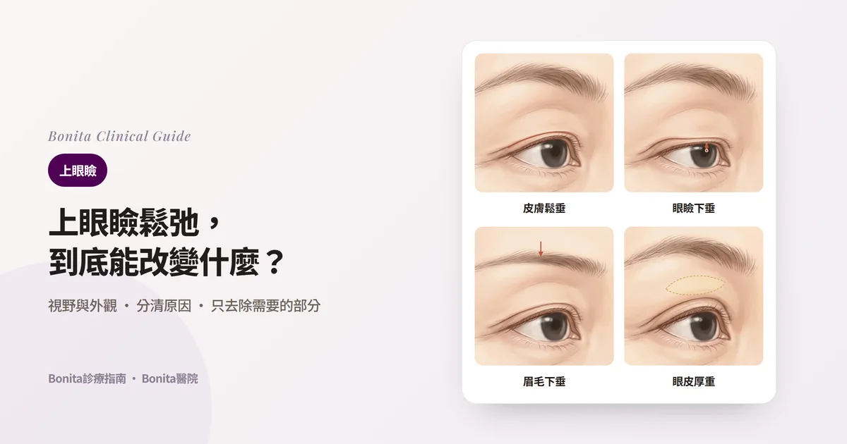 四張眼部插圖卡片：皮膚蓋住睫毛根部、眼瞼邊緣遮住黑眼珠、眉毛下移、上眼瞼顯得厚重，以及各自優先考慮的方法