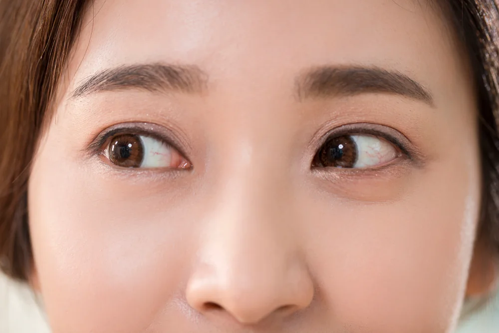 중년 눈 성형